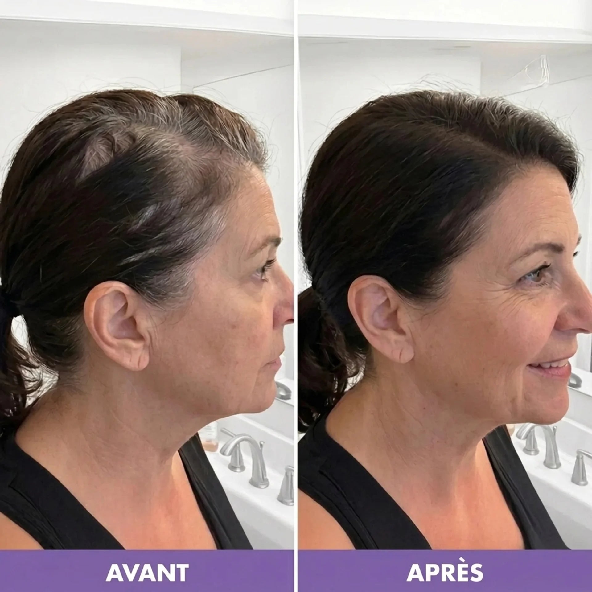 Luma Hair|Poudre Densifiante Cheveux