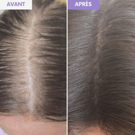 Luma Hair｜Poudre Densifiante Cheveux